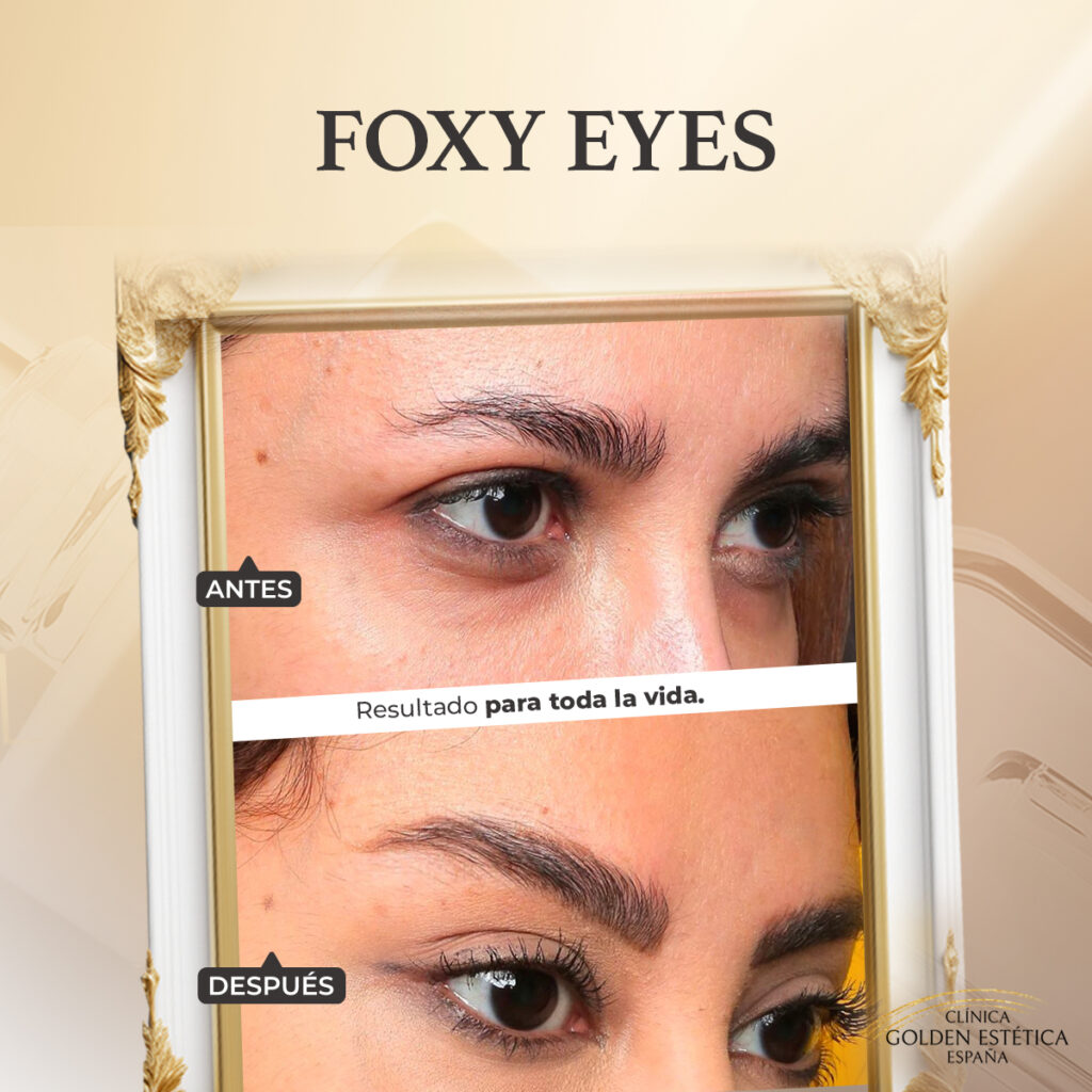 Foxy eyes antes y despues